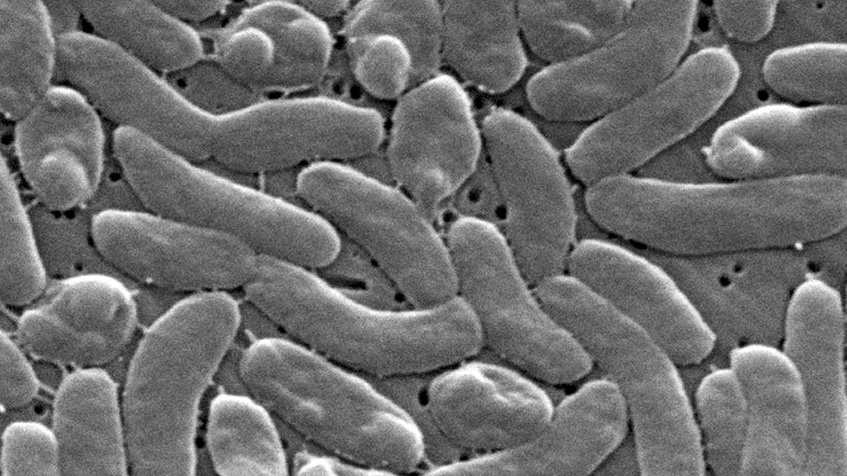 This 2005 electron microscope image provided by the Centers for Disease Control and Prevention shows Vibrio vulnificus bacteria.