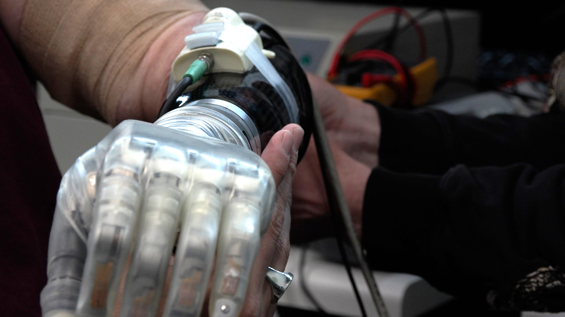 Bionic hands aren't just for Luke Skywalker