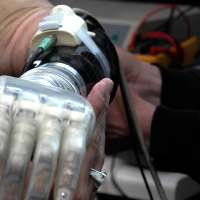 Bionic hands aren't just for Luke Skywalker