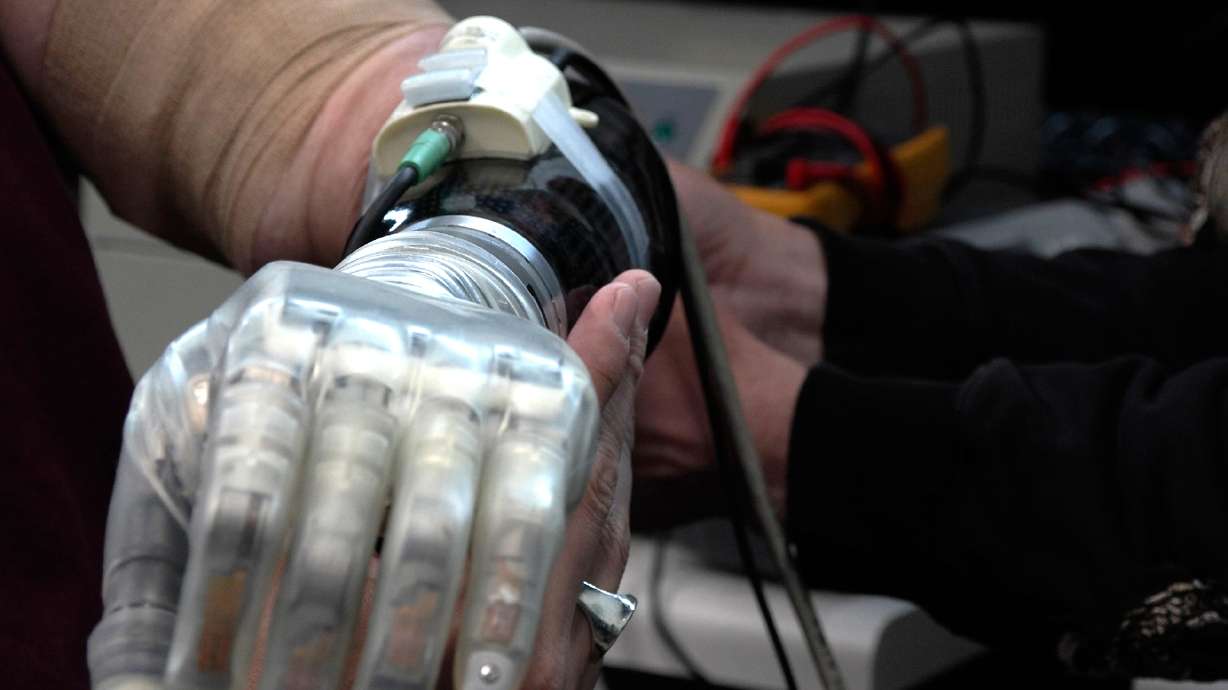 Alexander "Avi" Davidson, a therapist from Floriday, rotates his Life Under Kinetic Evolution, or LUKE, arm, on April 16.