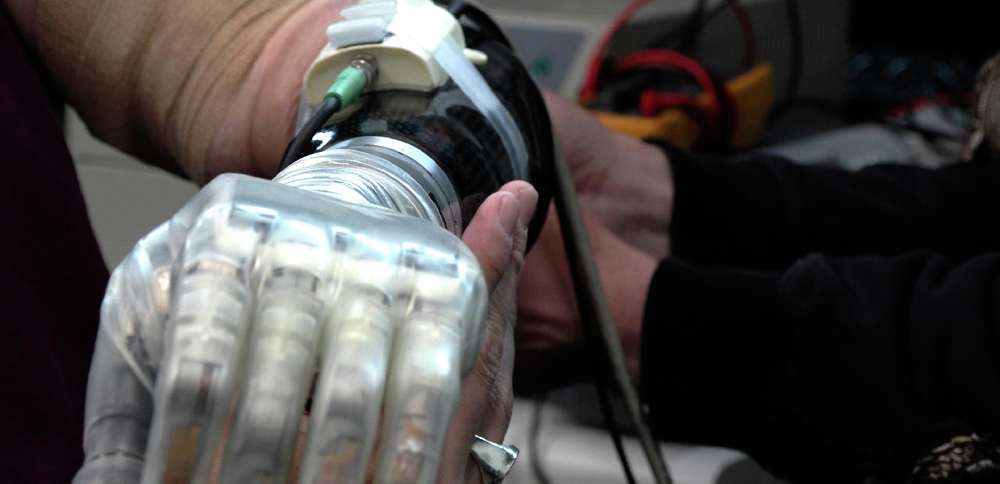 Bionic hands aren't just for Luke Skywalker