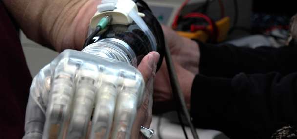 Bionic hands aren't just for Luke Skywalker