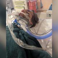 Roy teen shows signs of recovery after being hit by car while riding e-scooter