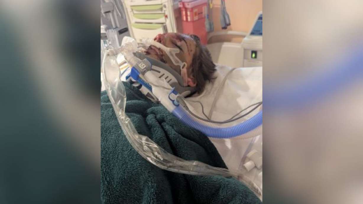 14-year-old Tucker is pictured at the hospital after he was hit by a car. His family says he is showing encouraging signs of recovery after being critically injured when he was struck by the car while riding his e-scooter last week.