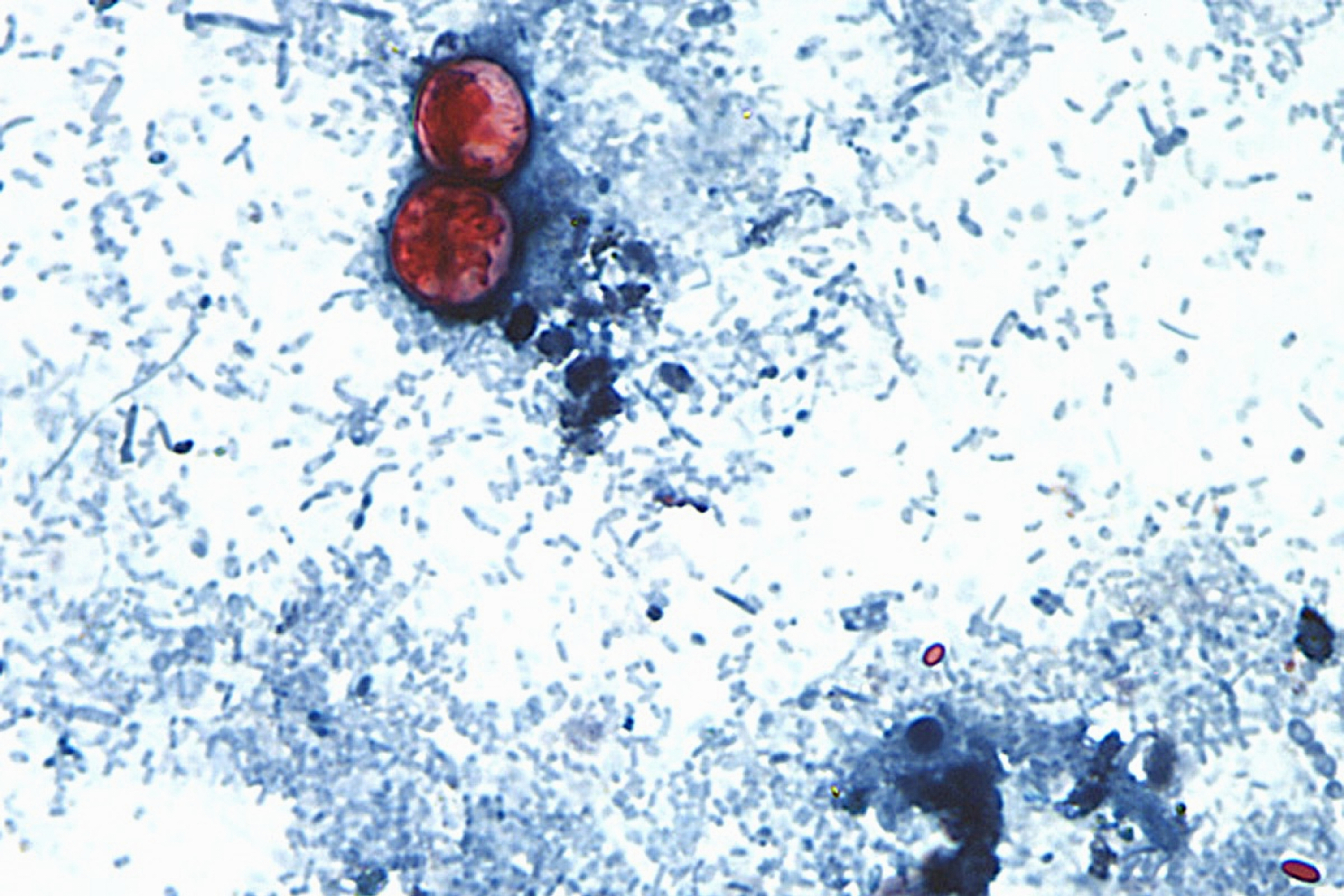 FILE - This undated photo taken through a microscope and provided by the CDC shows Cyclospora cayetanensis oocysts found in a fresh stool sample which had been prepared with a formalin solution and stained with safranin. 