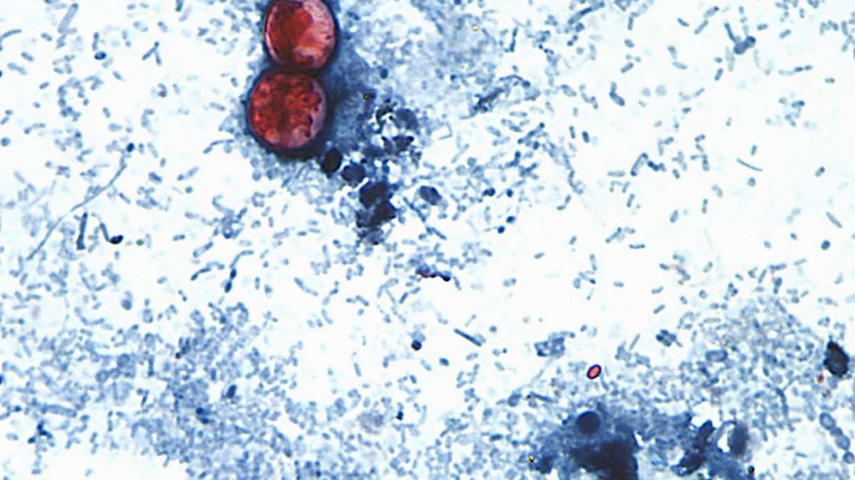 FILE - This undated photo taken through a microscope and provided by the CDC shows Cyclospora cayetanensis oocysts found in a fresh stool sample which had been prepared with a formalin solution and stained with safranin.