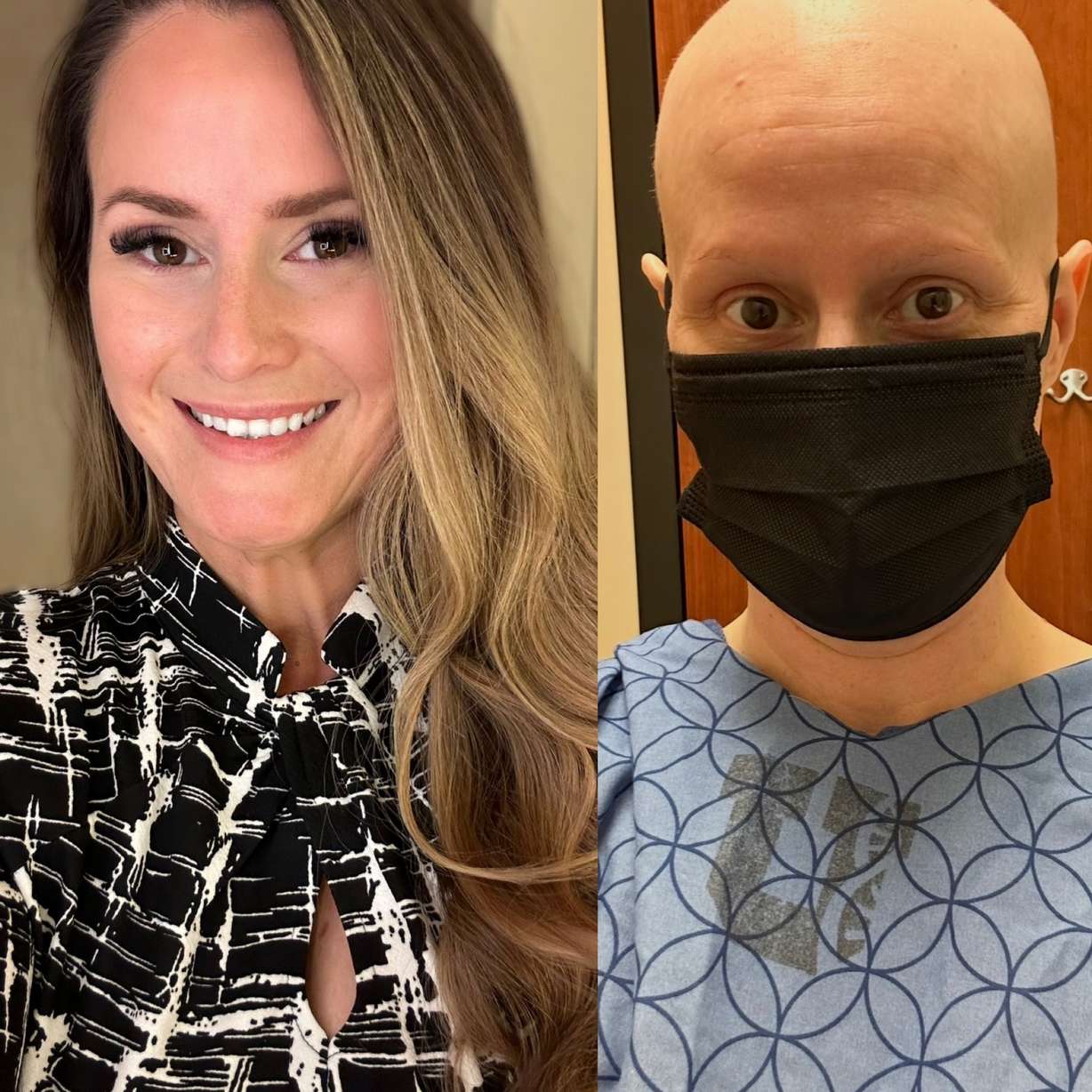 Katie Walterman before and after going through aggressive treatment for Stage 4 uterine cancer.