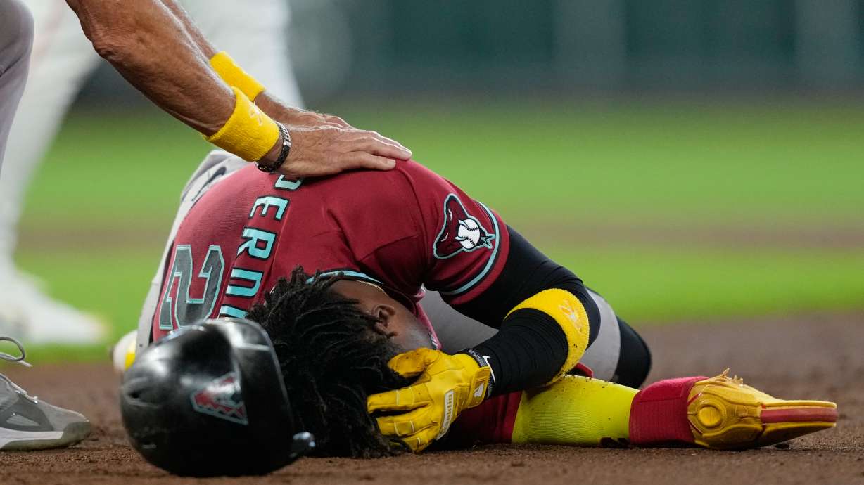 Arizona Diamondbacks' Geraldo Perdomo (2) holds his head after being hit by a line drive by Ketel Marte during the third inning of a baseball game against the Houston Astros Sunday, Sept. 6, 2026, in Houston.