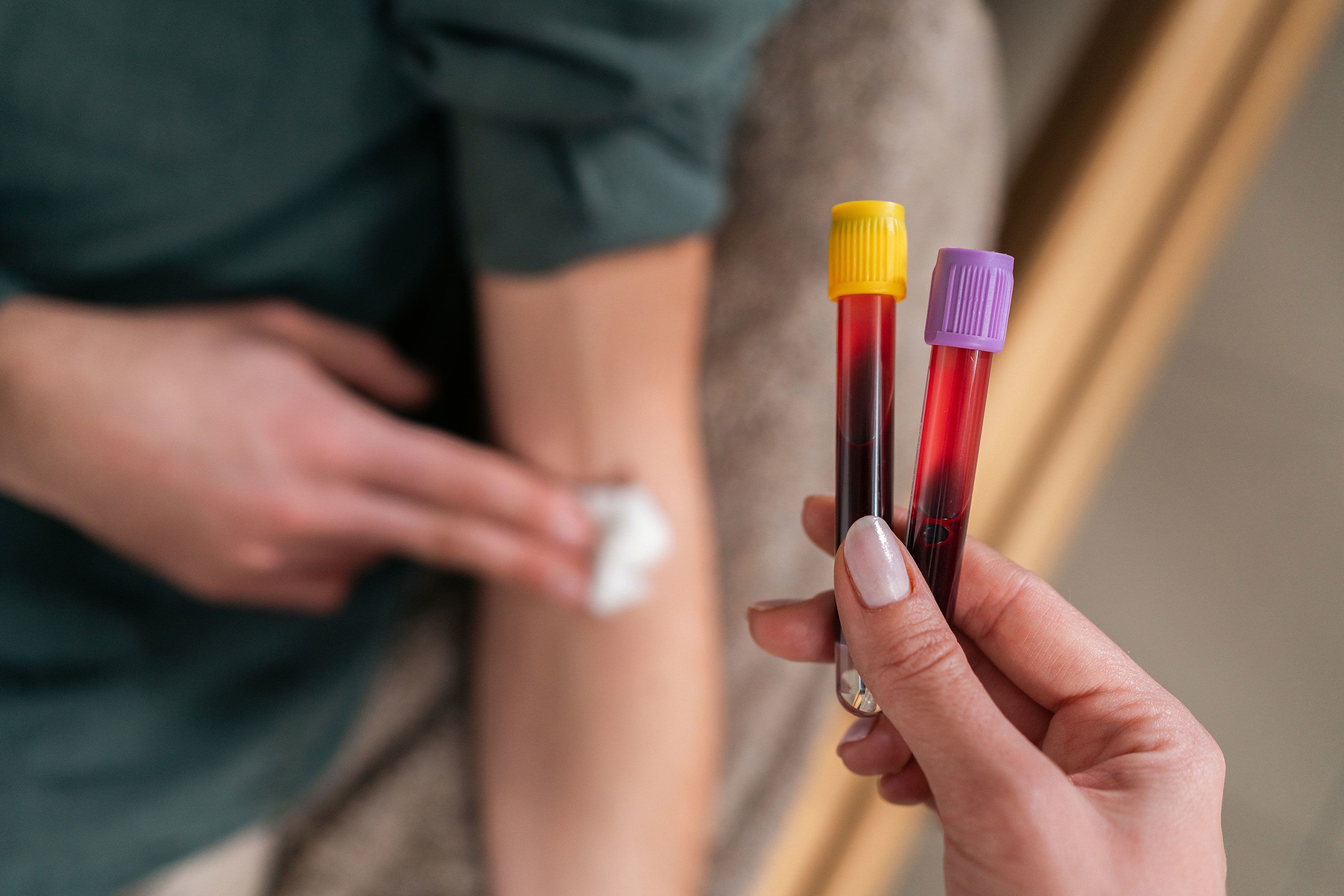 Lower levels of liver enzymes were linked to greater risk of early-onset colorectal cancer in a new analysis, but it's an association, not a cause, researchers say.