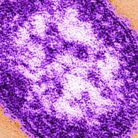Adult woman dies of measles complications in growing Pennsylvania outbreak