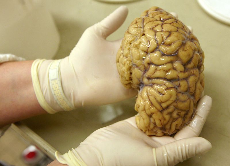 FILE PHOTO: A laboratory assistant holds one hemisphere of a healthy human brain in the Morphological unit of psychopathology in the Neuropsychiatry division of the Belle Idee University Hospital in Chene-Bourg near Geneva. Photograph taken March 14, 2011