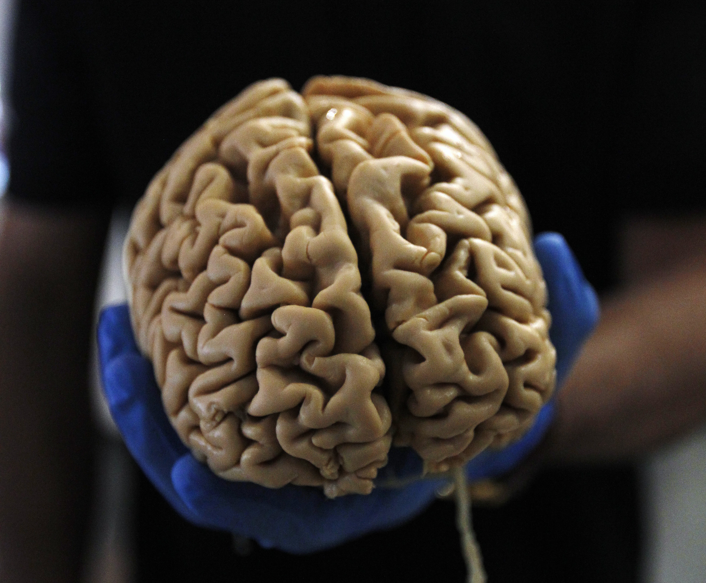 Tiny worms may help doctors treat human brain disease