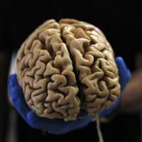 Tiny worms may help doctors treat human brain disease