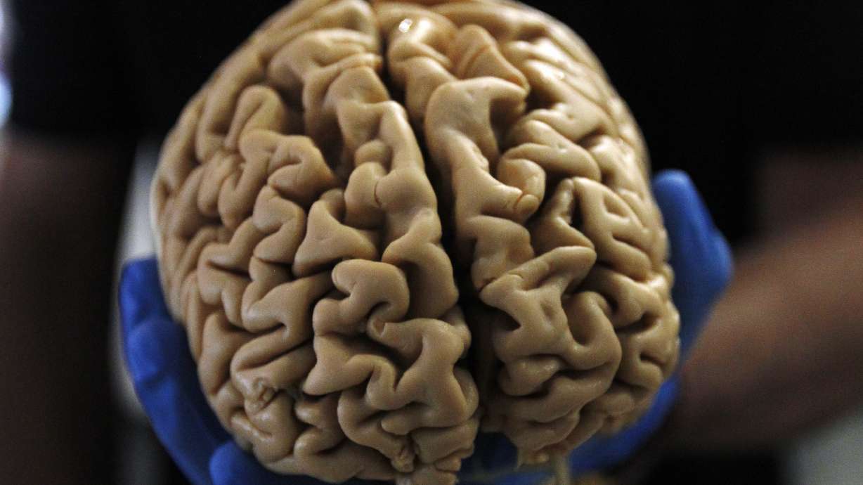 Mauricio Ramondini holds a human brain during Brain Awareness Day in Salt Lake City, March 21, 2015.
