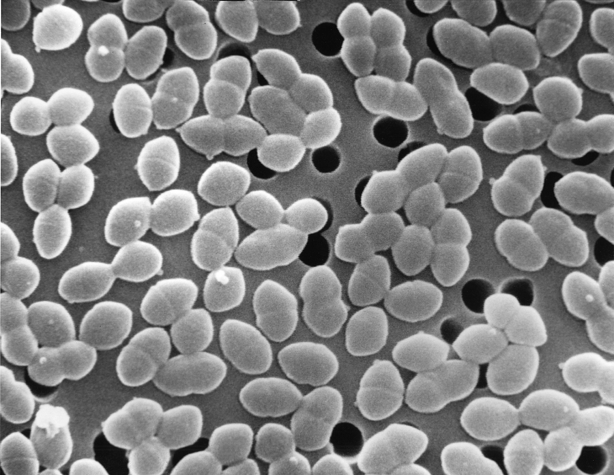 Antibiotic treatment combined with a sugary diet exacerbated and prolonged blooms of Enterococcus faecium bacteria in patients' guts.