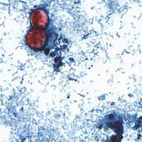 Cyclospora found at Mexican farm linked to lettuce outbreak, FDA says