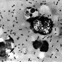 What is pneumonic plague and how dangerous is it?