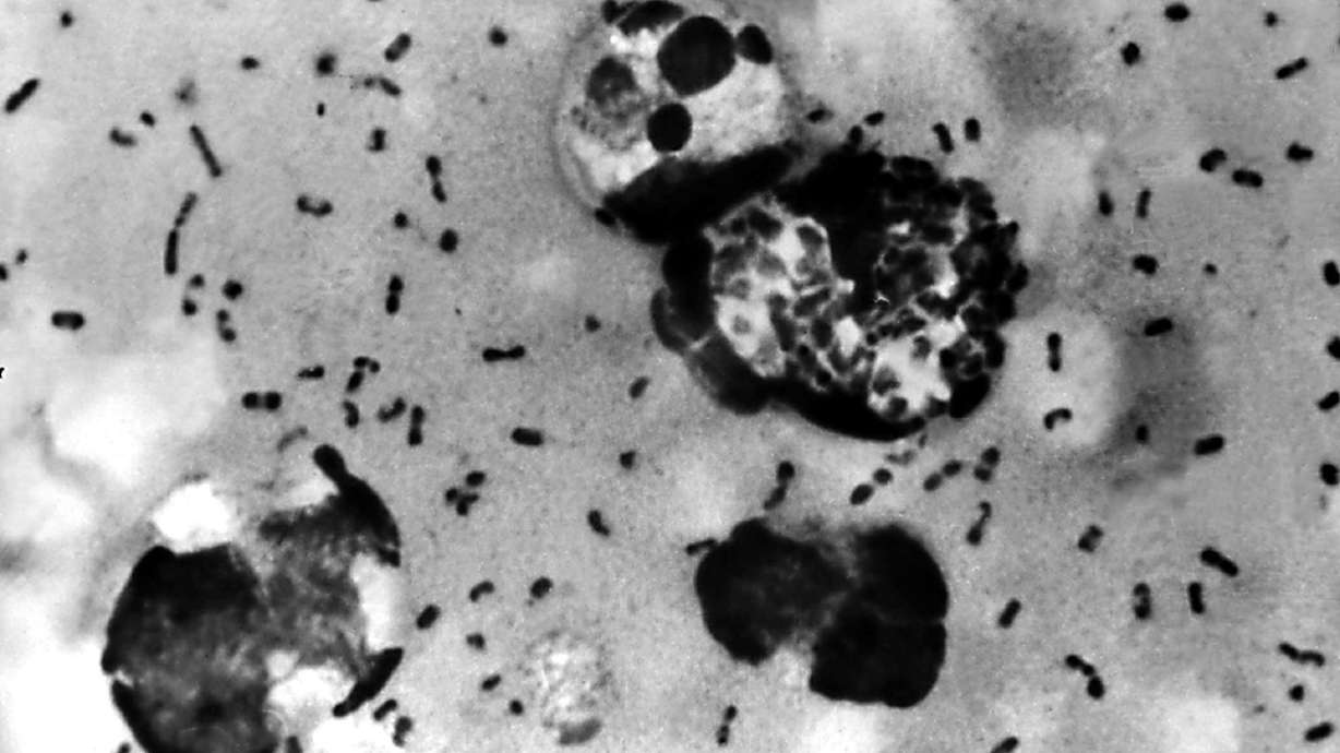 The bacteria Yersinia pestis causes plague, including the most common, bubonic plague, which typically results from the bite of an infected flea. Pneumonic plague is the most serious form of the illness. The U.S. State Department and Centers for Disease Control and Prevention said they are closely monitoring a death from pneumonia of an "unknown" origin.