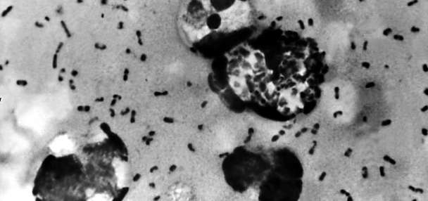 What is pneumonic plague and how dangerous is it?
