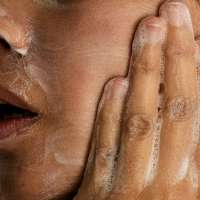 Adult acne is real, and treatable. Here's what to know