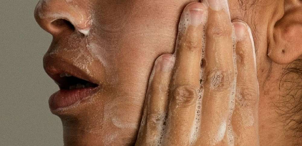 Adult acne is real, and treatable. Here's what to know