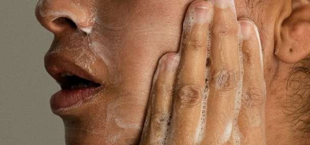 Adult acne is real, and treatable. Here's what to know