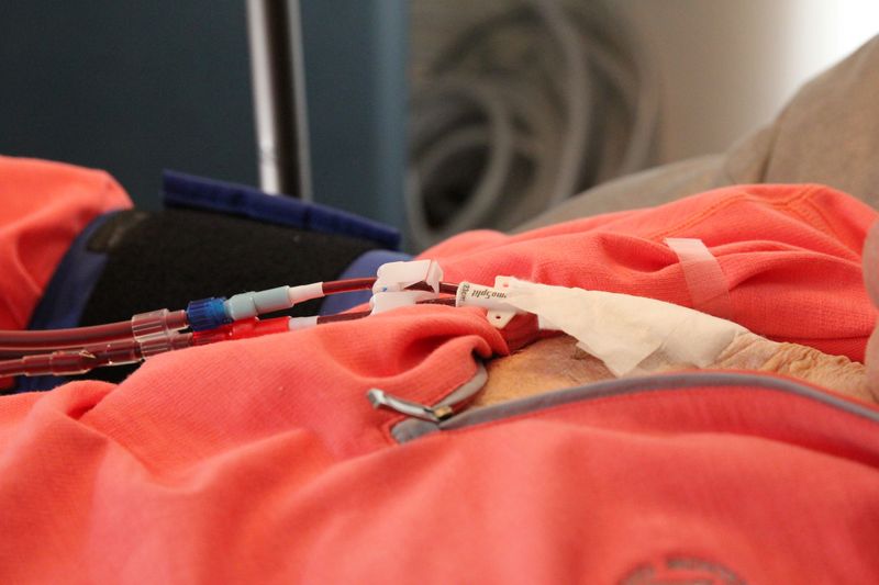 Vor Bio says its experimental drug slowed loss of kidney function in late-stage study