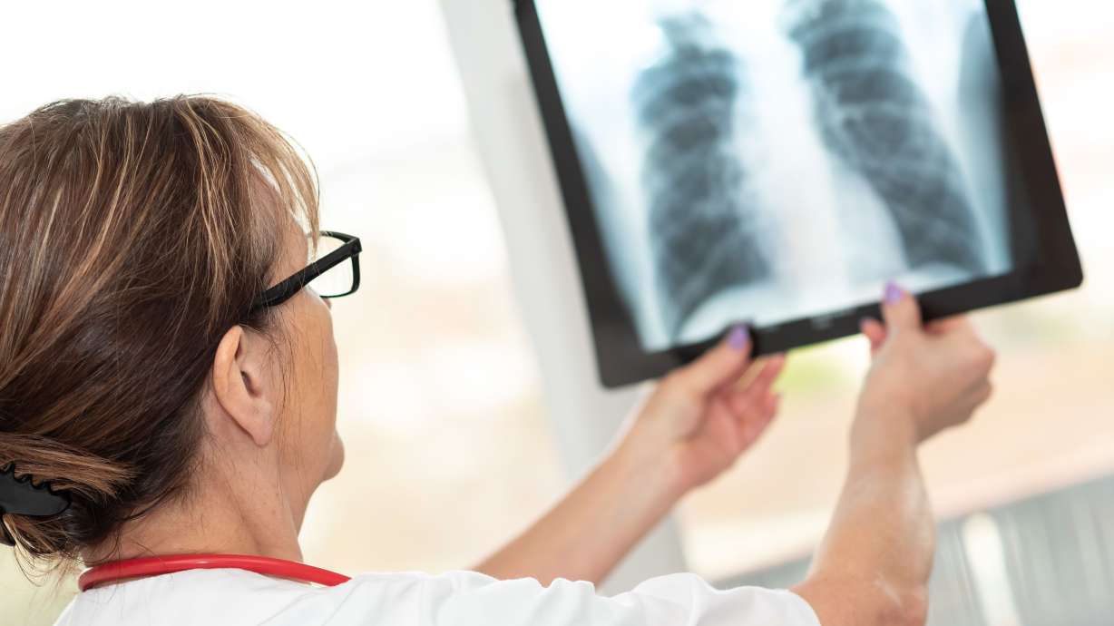 Beyond the lungs: New research links radon exposure to brain and ovarian cancer