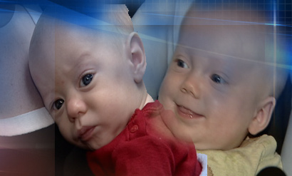 Specialized surgery to save babies in the womb performed in Utah