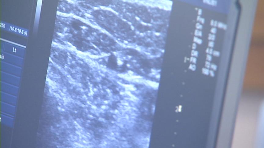 New varicose vein treatments becoming more common