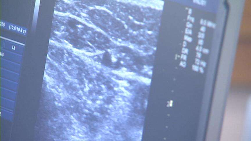 New varicose vein treatments becoming more common