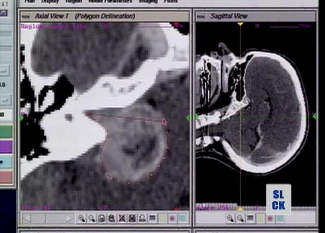 Hospital gets new tool in fight against cancer