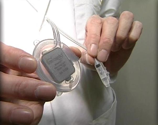 New therapy could help millions of people lose weight