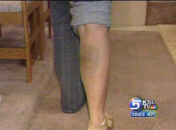 Woman Injured by Stray, Falling Bullet