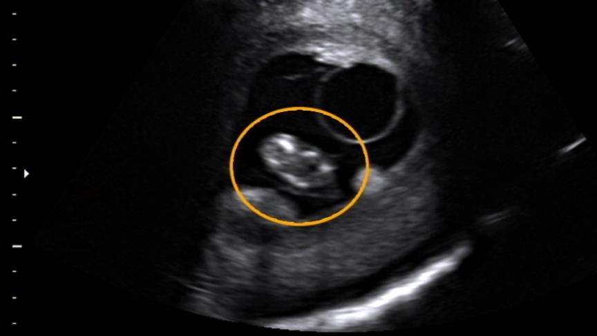 Zoo celebrating pregnancy of Christie the elephant