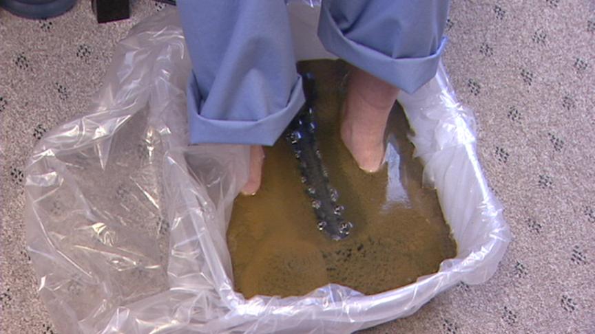 KSL examines a controversial therapy - detoxifying foot baths