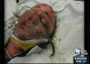 Idaho family survives house explosion