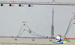 BYU Researchers Announce Breakthrough in Diagnosing Eating Disorders