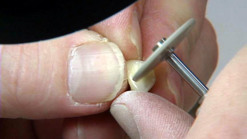 Restorative dental work could be hazardous to your health