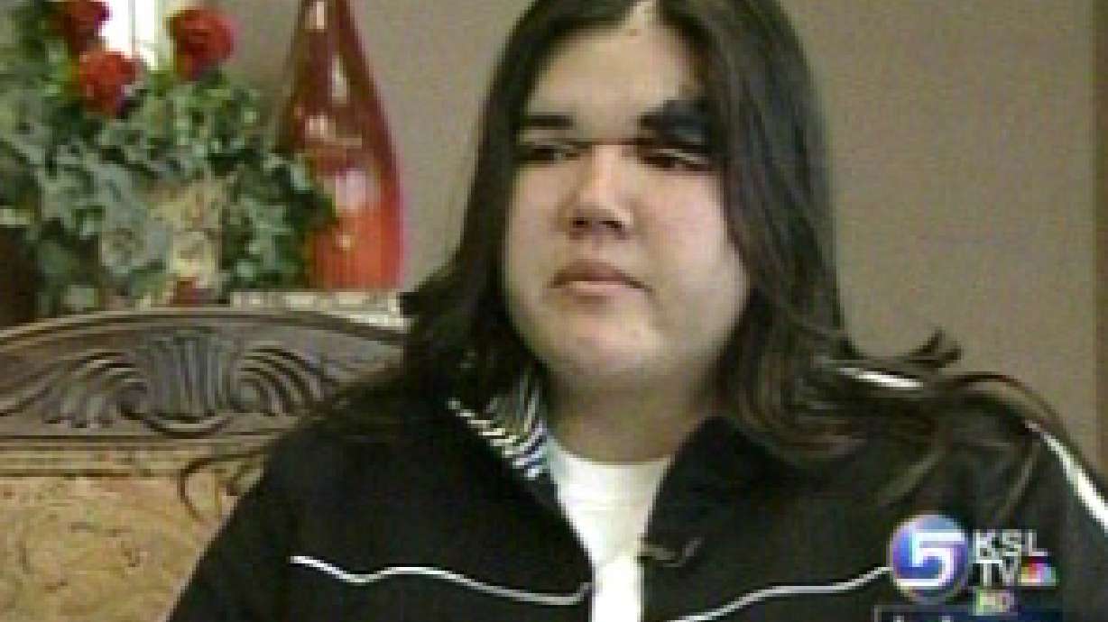 Woman's scalp torn from head by go-cart