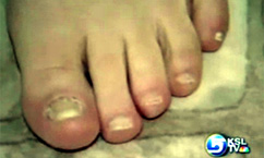 How Safe Are Pedicures?