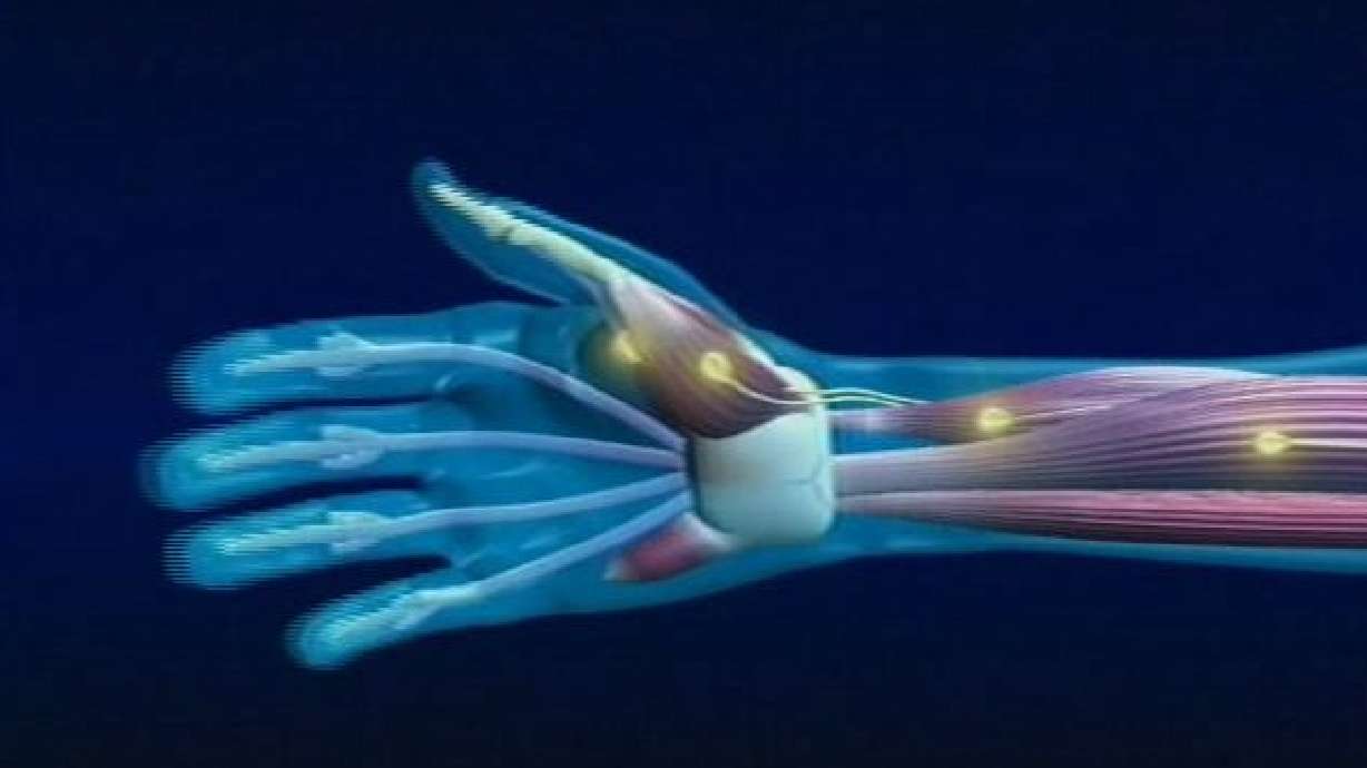 DARPA Researching Regeneration of Limbs