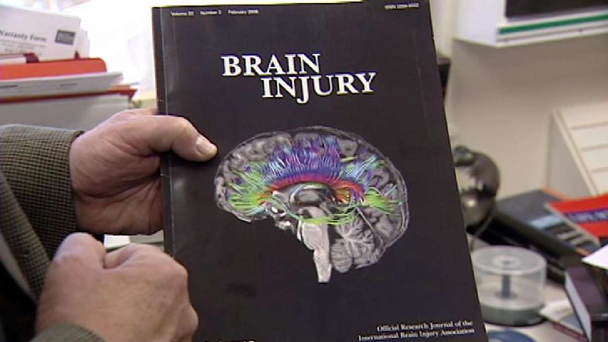 New imaging system helps researchers study concussions