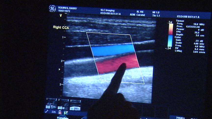 Patient tested for 'white matter disease'