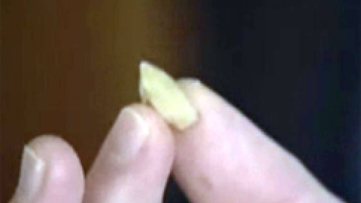 Fake Vampire Tooth Causes Trouble