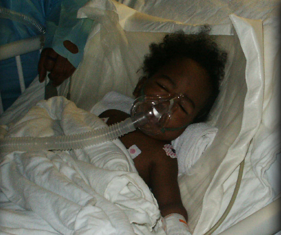 Mother Speaks About Baby Burned by Father