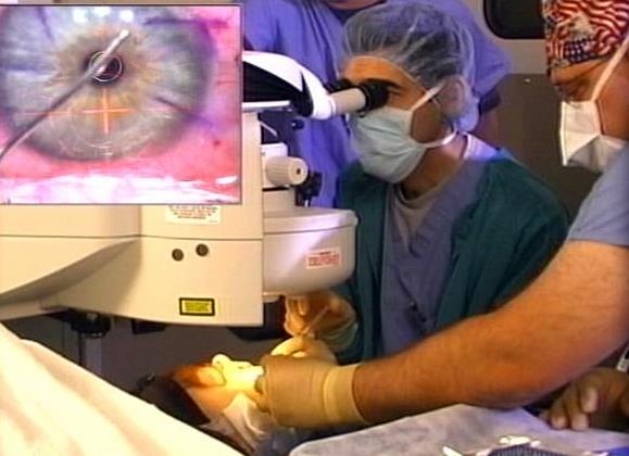 Lasik surgery: Not all patients should have it
