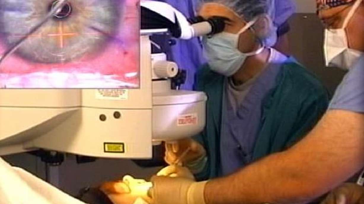 Lasik surgery: Not all patients should have it