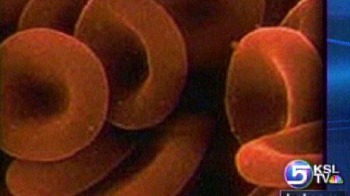 Thousands Unknowingly Infected with Hepatitis C