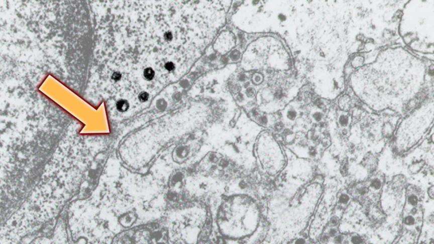 Researchers study hiding place of HIV